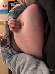 1753138901_where-did-all-these-stretch-marks-come-from_1.mp4