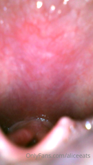 192355742_for-any-of-you-who-were-wondering-what-my-throat-looks-like_0.m4v