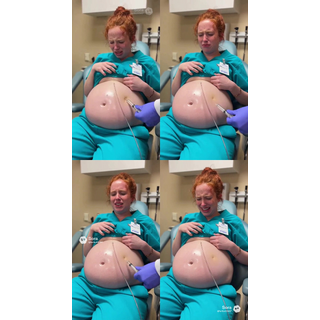 fartbutt5467--53441703_s_6939a7fa85f48191ad69677f6f1c834d.jpg