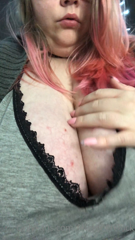 75324349_ignore-the-scars-my-cat-likes-to-make-my-boobs-into-biscu_0.m4v