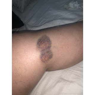 gothbatty_Can_you_give_me_more_bruises_daddy_please_2041616009.jpeg